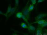 SDCCAG8 Antibody in Immunocytochemistry (ICC/IF)