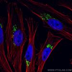 p115, USO1 Antibody in Immunocytochemistry (ICC/IF)