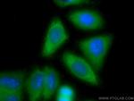 Spartin, SPG20 Antibody in Immunocytochemistry (ICC/IF)