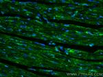 PARK2/Parkin Antibody in Immunohistochemistry (Paraffin) (IHC (P))