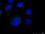 CEP250/CNAP1 Antibody in Immunocytochemistry (ICC/IF)