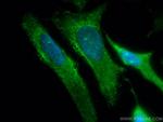 SPAG5 Antibody in Immunocytochemistry (ICC/IF)