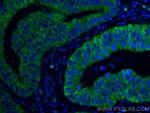 Amphiregulin Antibody in Immunohistochemistry (Paraffin) (IHC (P))