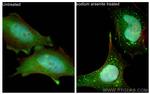 G3BP2 Antibody in Immunocytochemistry (ICC/IF)