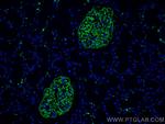 Podocalyxin Antibody in Immunohistochemistry (Paraffin) (IHC (P))