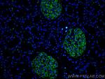 Podocalyxin Antibody in Immunohistochemistry (Paraffin) (IHC (P))