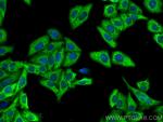 LDHA Antibody in Immunocytochemistry (ICC/IF)