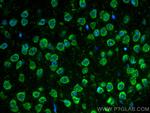 S1PR2 Antibody in Immunohistochemistry (Paraffin) (IHC (P))