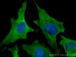 ROCK1 Antibody in Immunocytochemistry (ICC/IF)