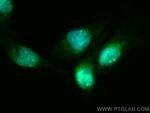 NFATC2 Antibody in Immunocytochemistry (ICC/IF)