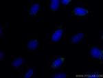 CEP164 Antibody in Immunocytochemistry (ICC/IF)