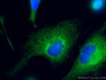 pan-keratin Antibody in Immunocytochemistry (ICC/IF)