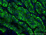 pan-keratin Antibody in Immunohistochemistry (Paraffin) (IHC (P))