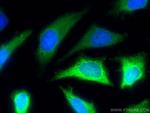 NDRG1 Antibody in Immunocytochemistry (ICC/IF)