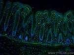 TGFBI/BIGH3 Antibody in Immunohistochemistry (Paraffin) (IHC (P))