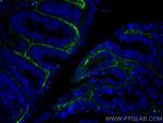 TGFBI/BIGH3 Antibody in Immunohistochemistry (Paraffin) (IHC (P))