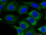 LGALS3BP Antibody in Immunocytochemistry (ICC/IF)