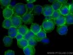 IFITM1 Antibody in Immunocytochemistry (ICC/IF)