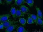 Septin 2 Antibody in Immunocytochemistry (ICC/IF)