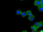 SNAP25 Antibody in Immunocytochemistry (ICC/IF)