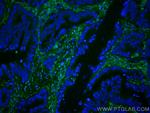 Galectin-1 Antibody in Immunohistochemistry (Paraffin) (IHC (P))