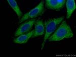 SND1 Antibody in Immunocytochemistry (ICC/IF)