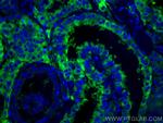 Thyroglobulin Antibody in Immunohistochemistry (Paraffin) (IHC (P))