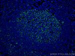 IL-19 Antibody in Immunohistochemistry (Paraffin) (IHC (P))