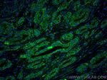 LIN28 Antibody in Immunohistochemistry (Paraffin) (IHC (P))