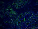 Protein C inhibitor Antibody in Immunohistochemistry (Paraffin) (IHC (P))