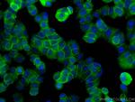 Annexin A2 Antibody in Immunocytochemistry (ICC/IF)