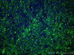 RBP4 Antibody in Immunohistochemistry (Paraffin) (IHC (P))