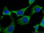 CSK Antibody in Immunocytochemistry (ICC/IF)