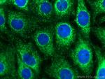 C9orf72 Antibody in Immunocytochemistry (ICC/IF)