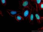 ANP32B Antibody in Immunocytochemistry (ICC/IF)