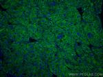 Transferrin Antibody in Immunohistochemistry (Paraffin) (IHC (P))