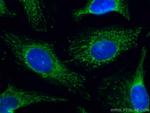 VAPB Antibody in Immunocytochemistry (ICC/IF)