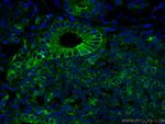 Beta-2-Microglobulin Antibody in Immunohistochemistry (Paraffin) (IHC (P))