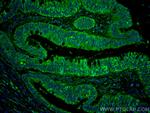 ST6GALNAC6 Antibody in Immunohistochemistry (Paraffin) (IHC (P))