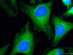 JNK Antibody in Immunocytochemistry (ICC/IF)