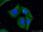 ORM2 Antibody in Immunocytochemistry (ICC/IF)