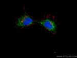 S100A10 Antibody in Immunocytochemistry (ICC/IF)