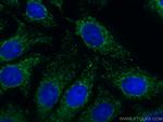 UCHL1/PGP9.5 Antibody in Immunocytochemistry (ICC/IF)