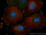 FAK Antibody in Immunocytochemistry (ICC/IF)