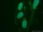 PHF10 Antibody in Immunocytochemistry (ICC/IF)