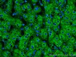 Plasminogen Antibody in Immunohistochemistry (Paraffin) (IHC (P))