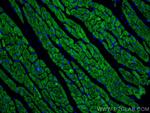 Calsequestrin 2 Antibody in Immunohistochemistry (Paraffin) (IHC (P))