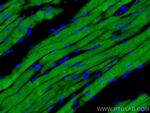 Calsequestrin 2 Antibody in Immunohistochemistry (Paraffin) (IHC (P))