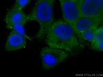 GDI1 Antibody in Immunocytochemistry (ICC/IF)