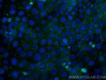 ZO-1 Antibody in Immunocytochemistry (ICC/IF)